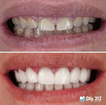 Slider image (5) Dis 212 - Dental Aesthetics Facility